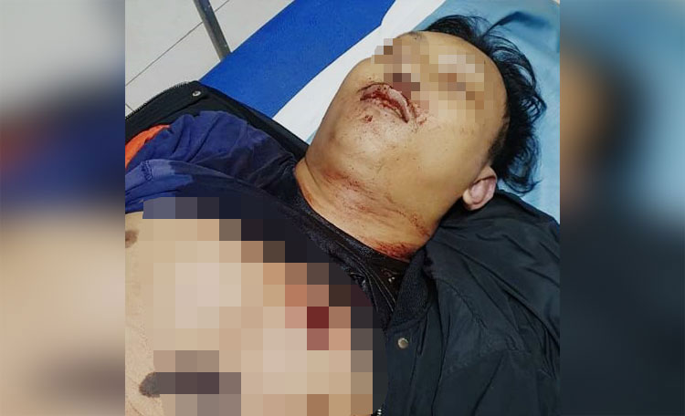 Kondisi korban ketika dibawa ke rumah sakit.