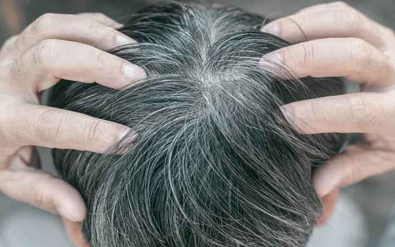 Usia Muda Tapi Rambut Sudah Beruban? Ini Makanan untuk Cegah Ubanan