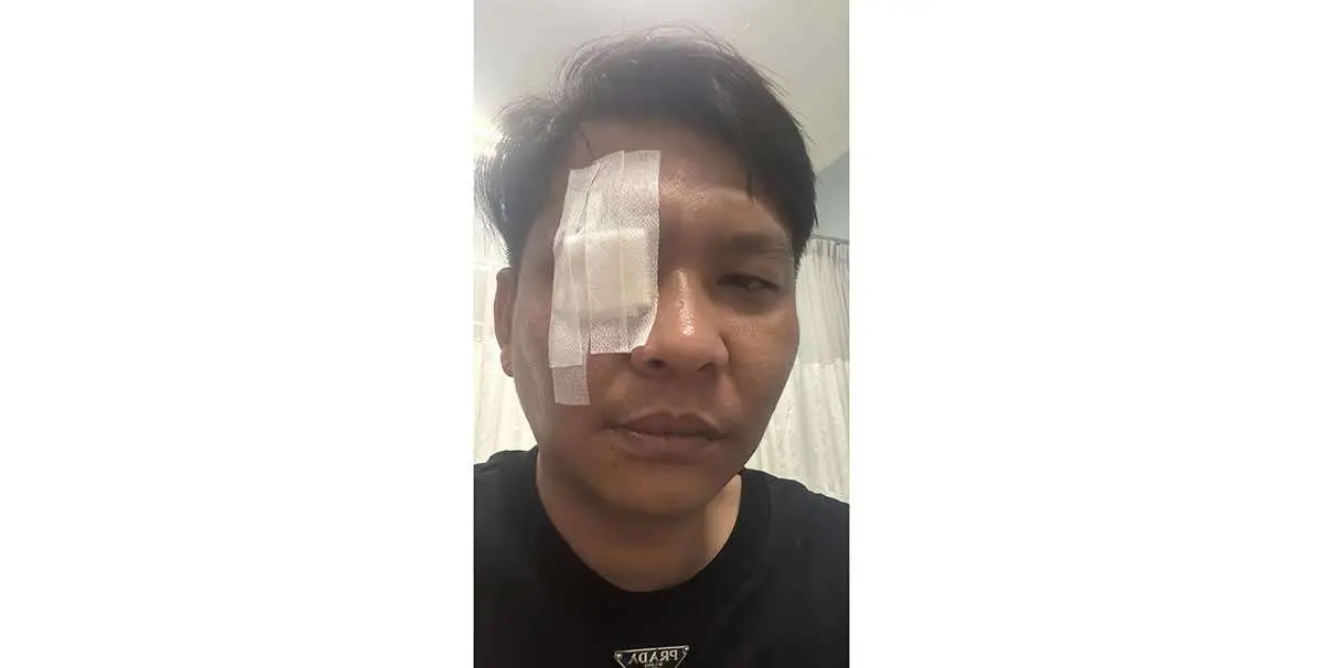 Warga Jakarta Jadi Korban Dugaan Pengeroyokan di Surabaya