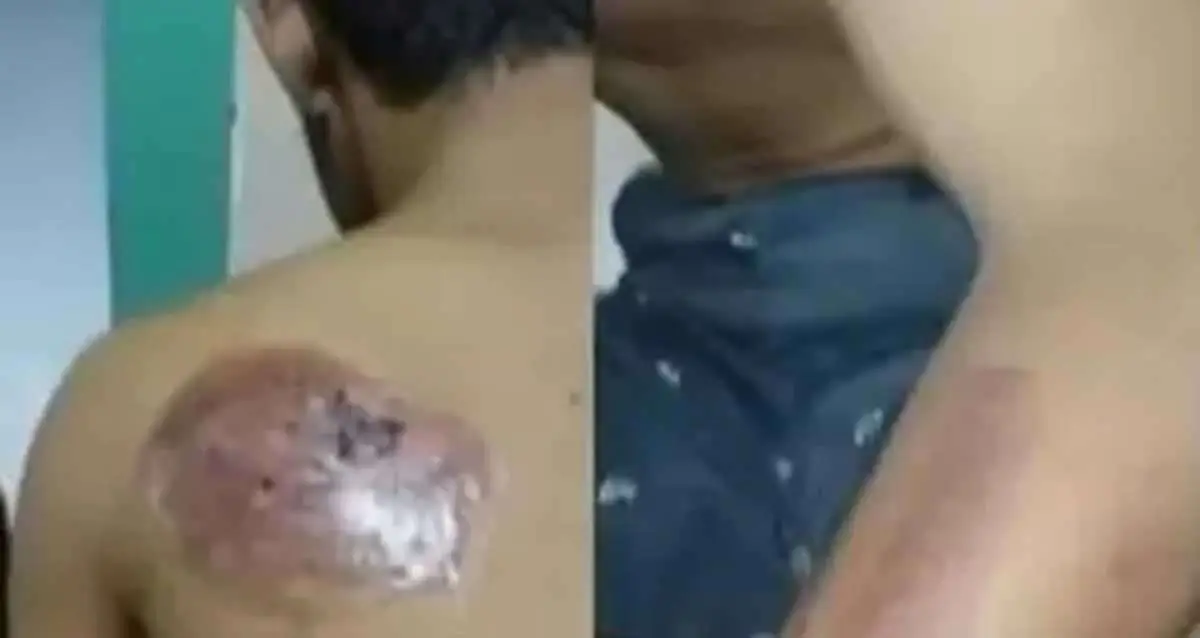 Santri Difabel di Gresik Diduga Jadi Korban Perundungan