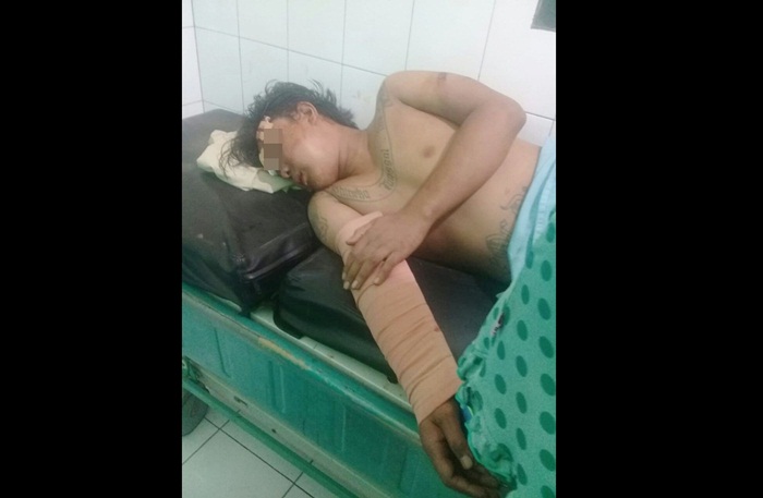 Pelaku saat menjalani perawatan usai dimassa.