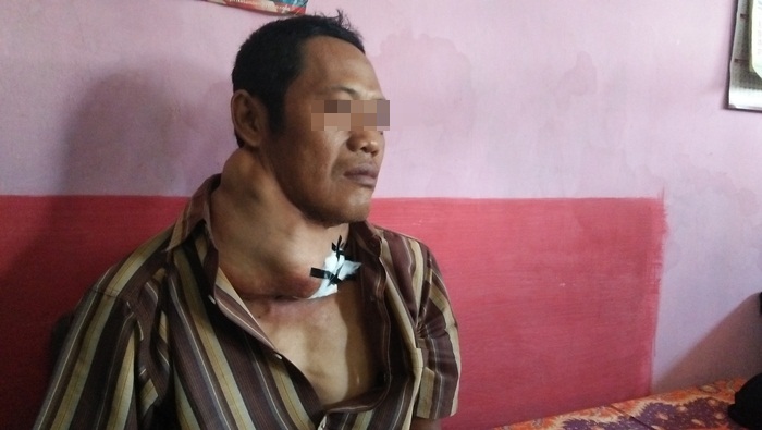 Derita Sukadi, Warga Miskin Penderita Tumor Ganas di Kesamben Jombang