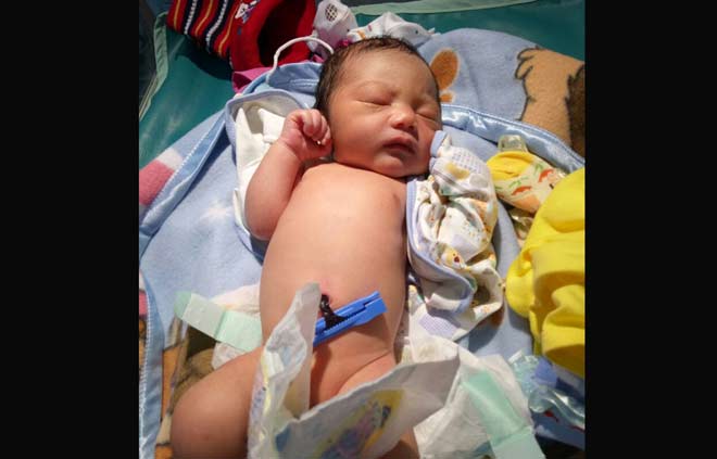 Bayi dirawat di RSUD Pare