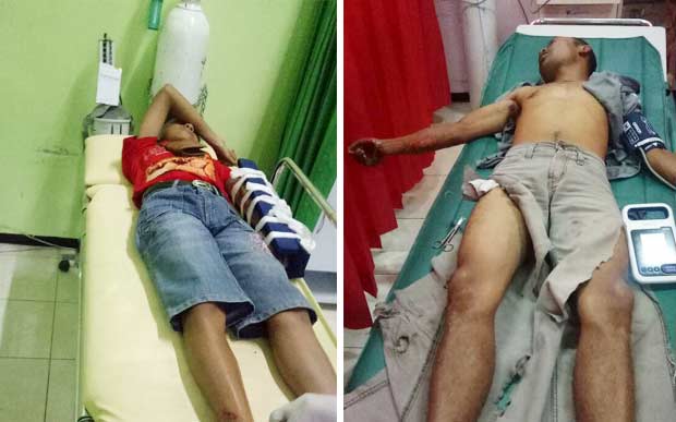 Avanza Vs Motor di Songgoriti, Satu Orang Patah Tulang
