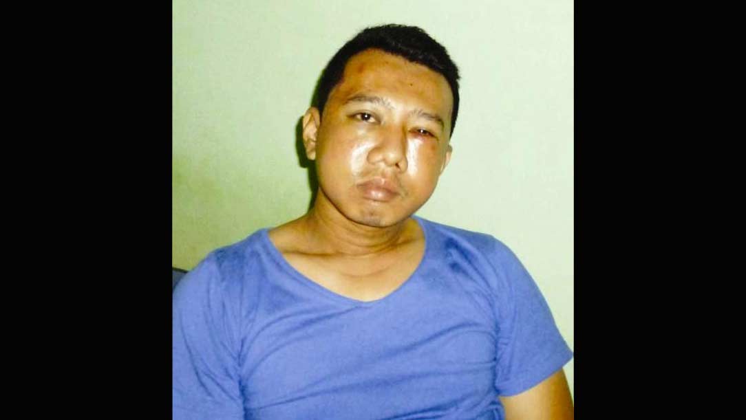 Bambang Wisnu Dwi Wardhana, korban penganiayaan oleh orang tak dikenal. foto: yudi eko purnomo/ BANGSAONLINE