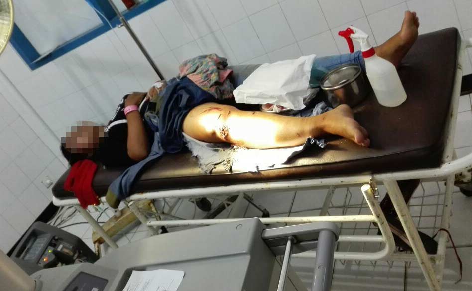 Kecelakaan di Desa Widoro: Mobil Vs 2 Motor, 1 Tewas