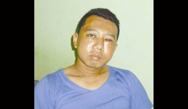 Polisi Tak Kunjung Ungkap Kasus Pengeroyokan Wartawan, Safri Nawawi: Polisi Jangan Ragu